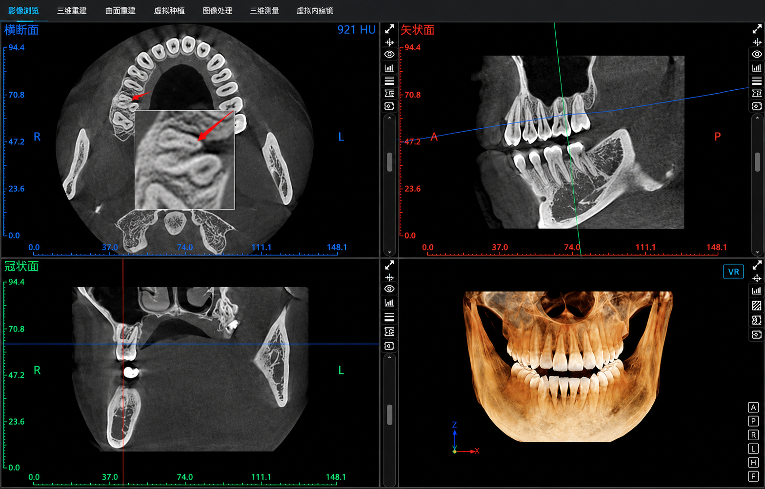 Imágenes de diagnóstico radiológico dental 2D y 3D